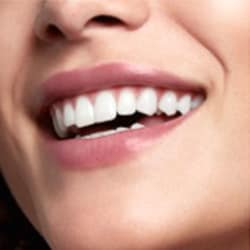 Dinti mai albi din prima zi - Nou! Set 2 x Periuta de dinti electrica Oral-B Pro 3 Cross Action